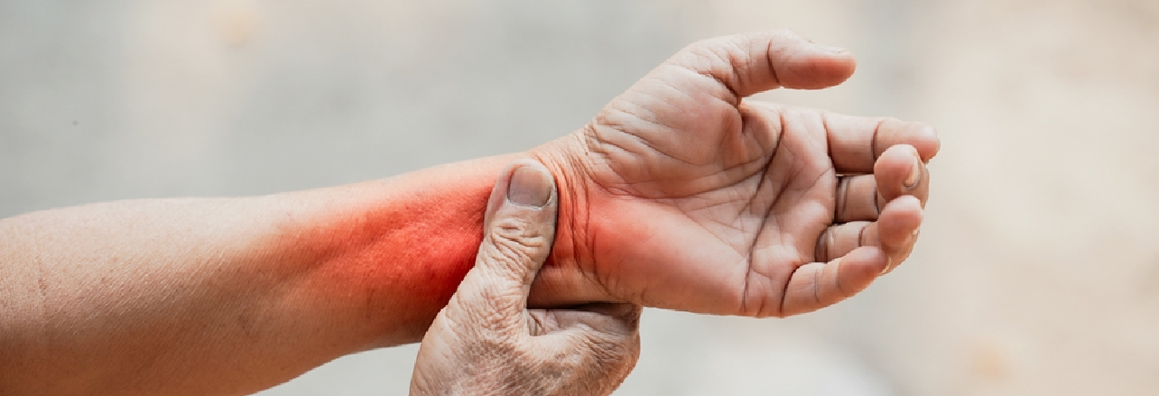 Rheumatology Clinical Trials in Alexandria, LA