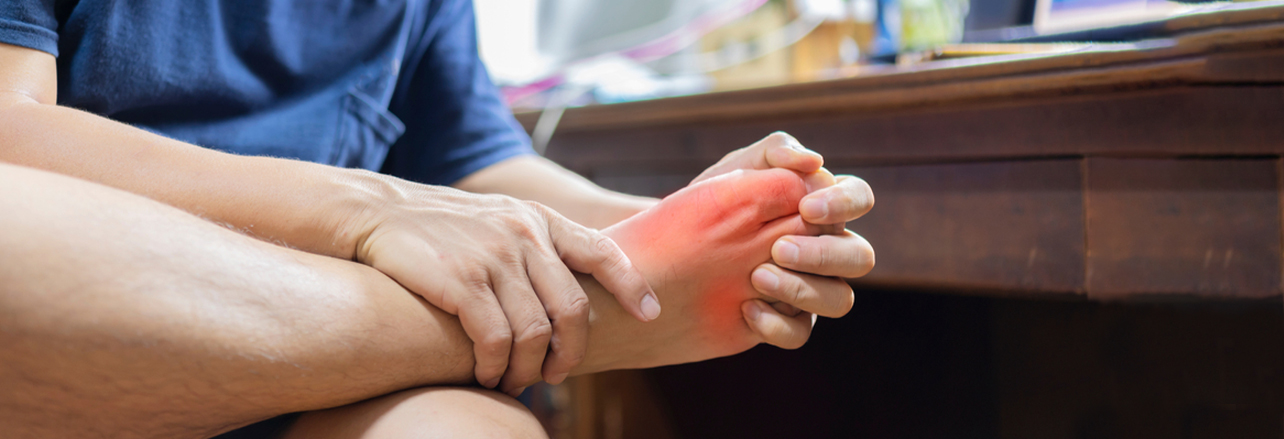 acute gout attack trials