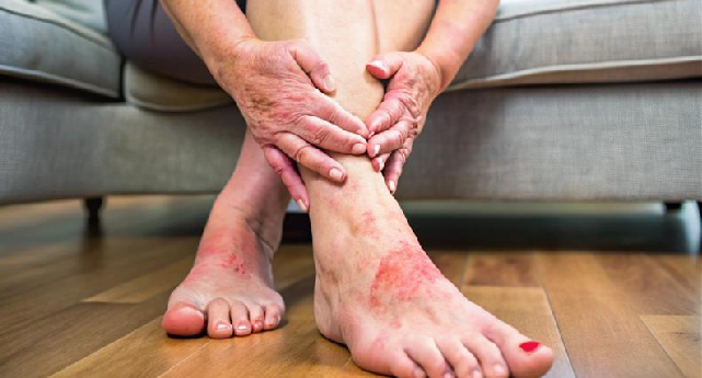 diabetic foot ulcer treatment