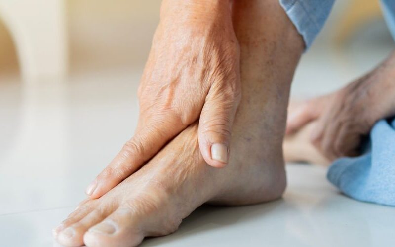 Non-Diabetic Foot Ulcer