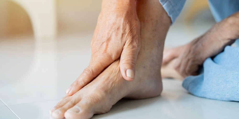 Non-Diabetic Foot Ulcer