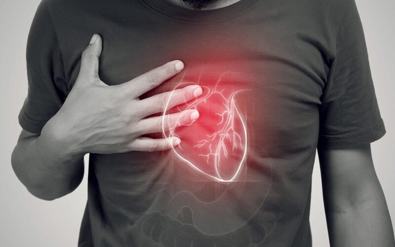 Acute Heart Failure