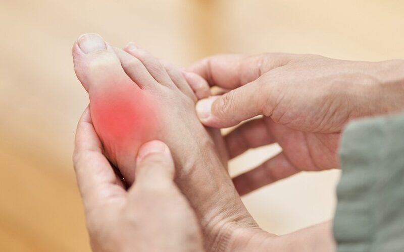 Is Gout Hereditary