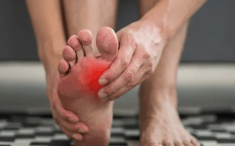 How to Get Rid of Gout Pain Fast