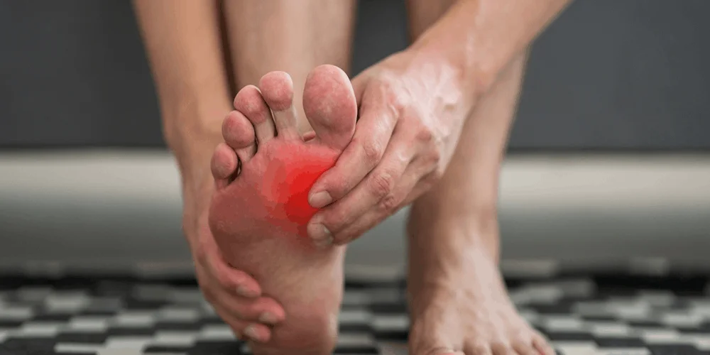 How to Get Rid of Gout Pain Fast