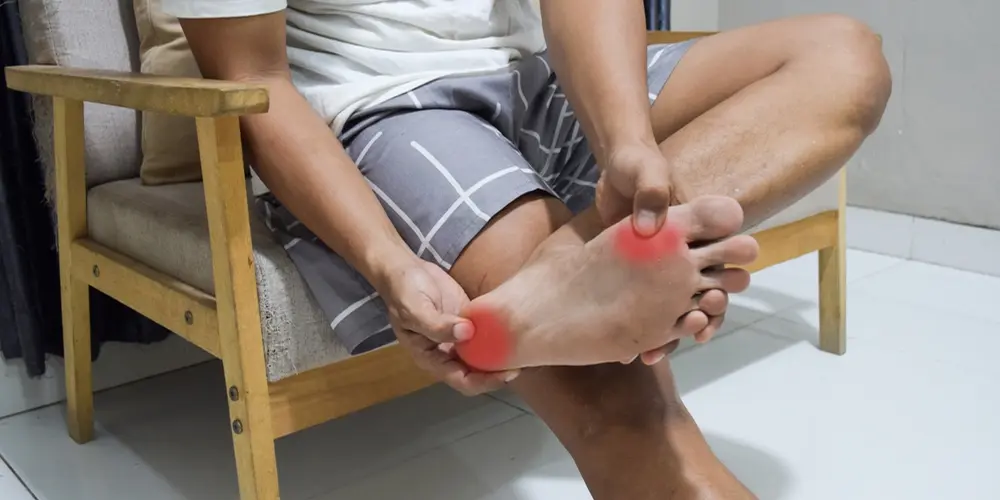 What Causes Gout Flare Ups